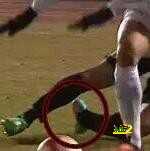 فيديو : لاعب غلطة سراى يتعرض لكسر فى ساقه ومنافسه يبكى من الصدمة