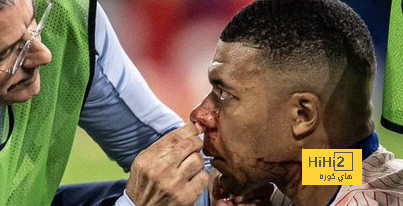 ديشامب يكشف مستجدات إصابة مبابي