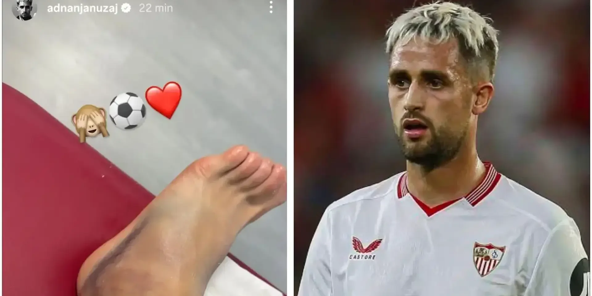 لاعب إشبيلية ينشر صورة صادمة لكاحله بعد مباراة برشلونة